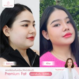 รีวิว Fat Face