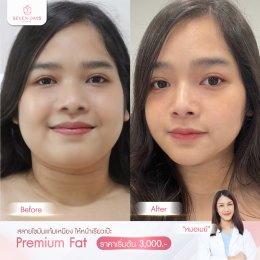 รีวิว Fat Face