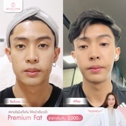 รีวิว Fat Face