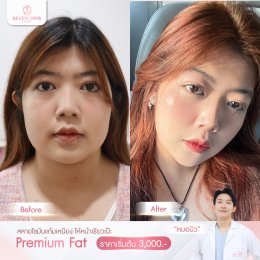 รีวิว Fat Face