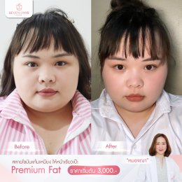 รีวิว Fat Face