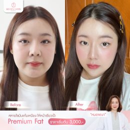 รีวิว Fat Face