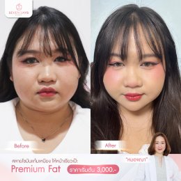 รีวิว Fat Face