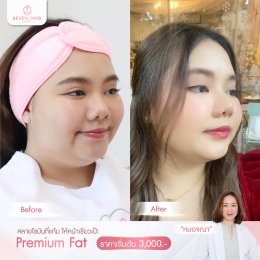 รีวิว Fat Face