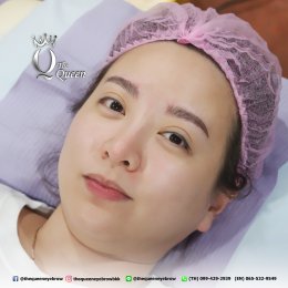 Eyebrow microblading