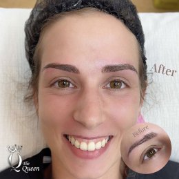 Eyebrow microblading