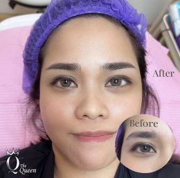 Eyebrow microblading