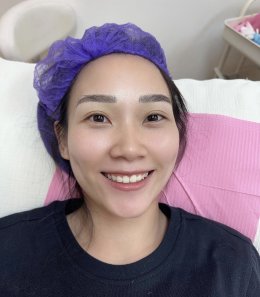 Eyebrow microblading