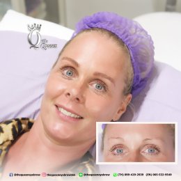 Eyebrow microblading