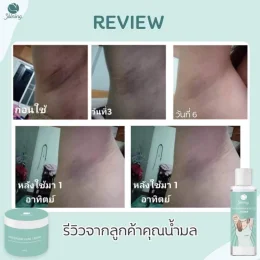 Shining Underarm Care | ครีมรักแร้ & โทนเนอร์ ใต้รักแร้ | ของแท้ 100%
