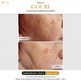 Gouri Collagen PCL 21% สร้างคอลลาเจนอย่างยั่งยืน เปลี่ยนผิวเก่าเป็นผิวใหม่