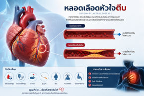 หลอดเลือดหัวใจตีบ...รู้ทันก่อนหัวใจขาดเลือด
