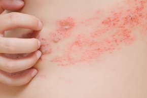 งูสวัดพันรอบตัวแล้วตายจริงไหม ? 