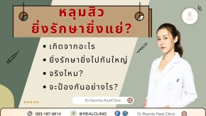 รักษาหลุมสิว ยิ่งรักษา ยิ่งแย่ลง มีจริงไหม หลุมสิวรักษาไม่ดีแย่ลงจริงไหม เกิดขึ้นได้อย่างไร?