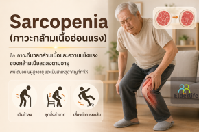 Sarcopenia คืออะไร?
