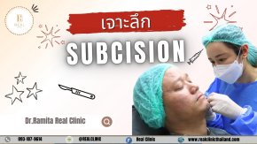 "Subcision ตัดพังผืด คืออะไร? อยากให้ผลลัพธ์ดีขึ้นควรทำอย่างไร ?