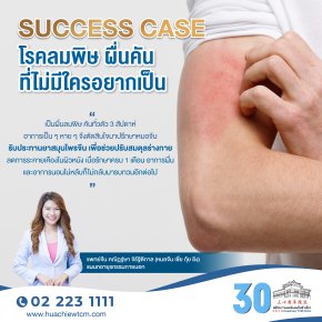 Success case โรคลมพิษ ผื่นคันที่ไม่มีใครอยากเป็น
