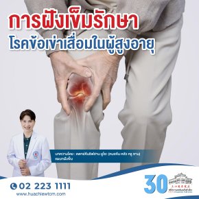 การฝังเข็มรักษาโรคข้อเข่าเสื่อมในผู้สูงอายุ