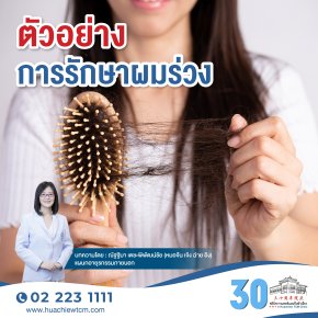 ตัวอย่างการรักษาผมร่วง