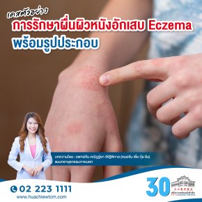เคสตัวอย่างการรักษาผื่นผิวหนังอักเสบ Eczema พร้อมรูปประกอบ
