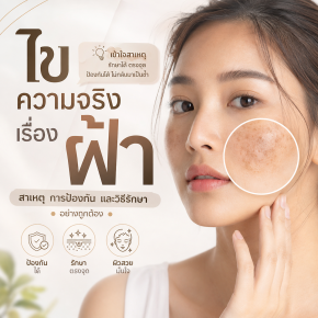 ไขความจริงเรื่องฝ้า กับหมอผิวหนังชื่อดัง สาเหตุ การป้องกัน วิธีรักษา ความเชื่อผิดๆ