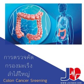 Colon Cancer Screening and Prevention