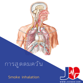 การสูดดมควัน