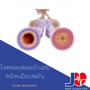 Acute Bronchitis 