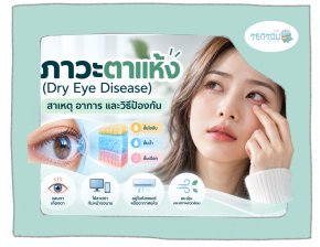 ภาวะตาแห้ง (Dry Eye Disease): สาเหตุ อาการ และวิธีป้องกัน