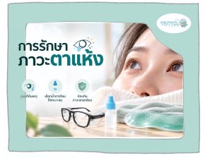 การรักษาภาวะตาแห้ง: ดูแลที่ต้นเหตุ เลือกน้ำตาเทียมให้เหมาะสม และป้องกันภาวะแทรกซ้อน