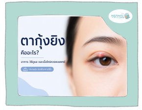 ตากุ้งยิง เกิดจากอะไร รักษายังไง ประคบร้อนหรือเย็นดี