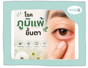 ภูมิแพ้ขึ้นตา คันตา ตาบวมแดง เกิดจากอะไร รักษายังไง