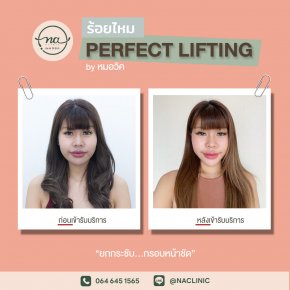 ร้อยไหม PERFECT LIFTING 6 เส้น by หมอวิค