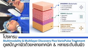 โปรแกรม Multimodality & Multilayer Discovery Pico VarioPulse Treatment