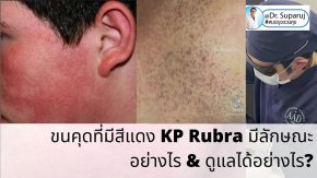  ขนคุดที่มีสีแดง KP Rubra มีลักษณะอย่างไร & ดูแลได้อย่างไร?