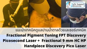 แนะนำเทคนิคดูแลปานน้ำตาล ด้วยเลเซอร์เทคนิค Fractional Pigment Toning FPT Discovery Picosecond Laser + Fractional 9 mm HC HP Handpiece