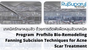 เทคนิครักษาหลุมสิว ด้วยการตัดพังผืดหลุมสิวเทคนิค Program Profhilo Bio-Remodeling Fanning Subcision Techniques for Acne Scar Treatment