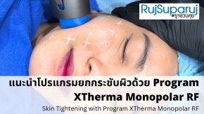 การดูแลความกระชับของผิวด้วย Program XTherma Monopolar RF