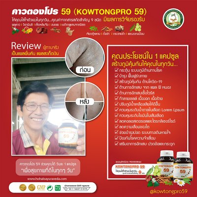 Reviews ผู้ทานผลิตภัณฑ์เสริมอาหารคาวตองโปร 59