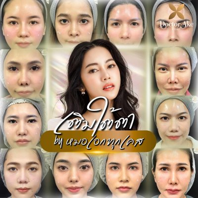 Filler ใต้ตา