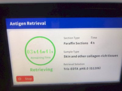 (ARI-4) Antigen Retrieval System by Servicebio
