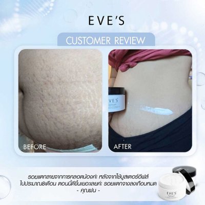 รีวิวคุณแม่ตั้งครรภ์ รีวิวคุณแม่ตั้งครรภ์