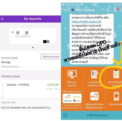 รีวิว เคลมประกันสุขภาพ