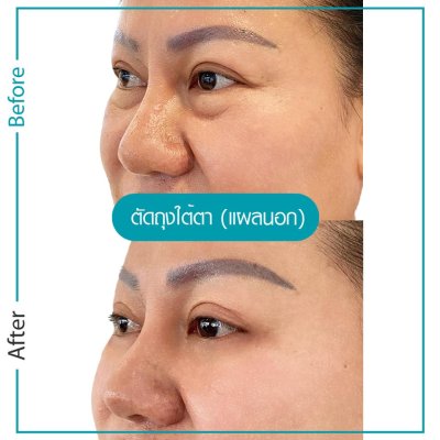 รีวิวตา