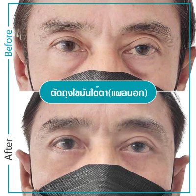 รีวิวตา