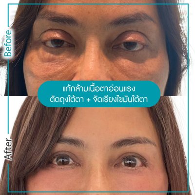 รีวิวตา