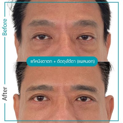 รีวิวตา