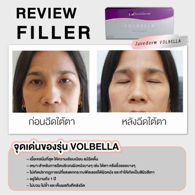 รีวิวฟิลเลอร์ใต้ตา