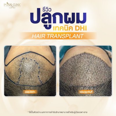 Salepage Review