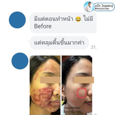 Testimonials รีวิวผลการรักษา ความประทับใจจากคนไข้ ที่มาใช้บริการที่  DeMed Clinic